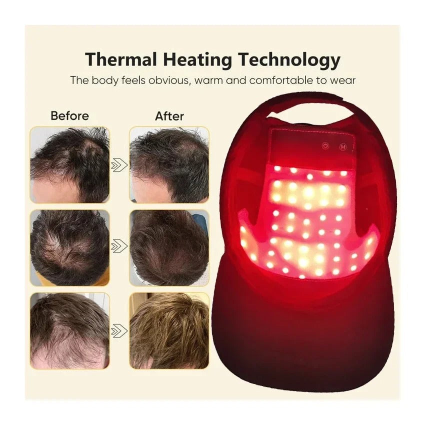 Red Light Hair Growth Cap Infrared Anti-hair Loss Therapy Device Prevents Hair Loss and Promotes Scalp Blood Circulation