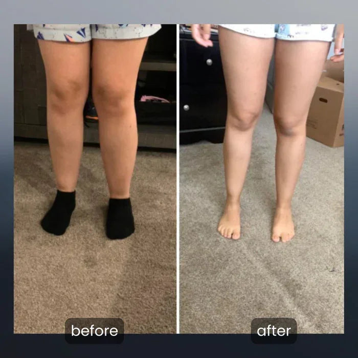 Vacuum Cupping Body Massager – Anti-Cellulite & Fat Burner